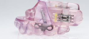 snarkskena-stockholm Snarskena snarkskena apotek snarkskena bäst i test